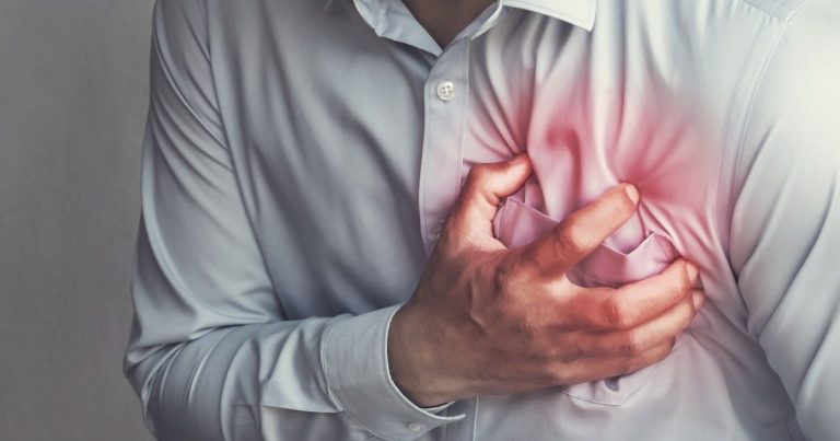 Infarto del miocardio