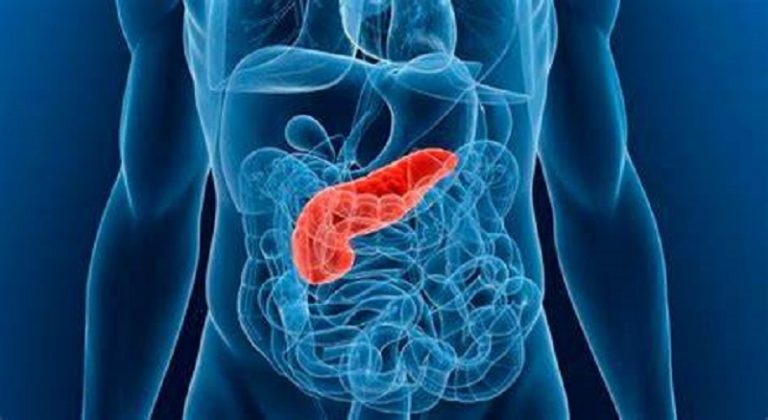 Pancreatitis aguda. Fuente: OPGE.org