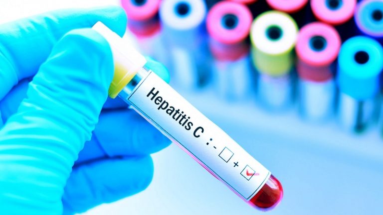 Hepatitis C diagnóstico