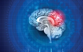 Cerebro