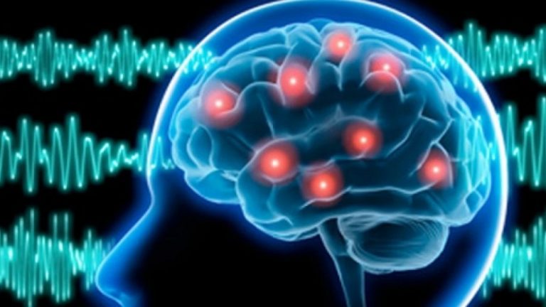 Epilepsia. Fuente: Psicología y mente