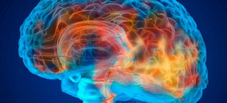 Cerebro alzheimer