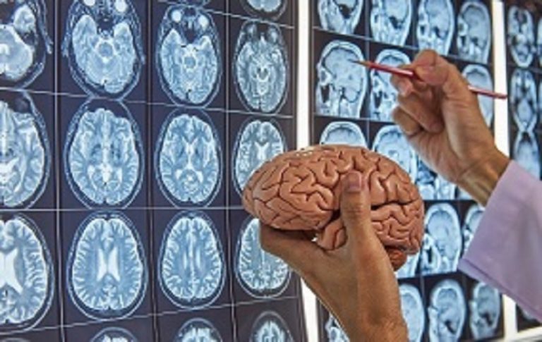 Cerebro