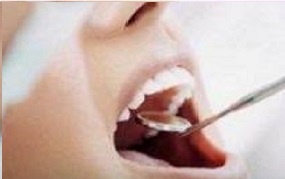 Día latinoamericano de lucha contra el cáncer bucal