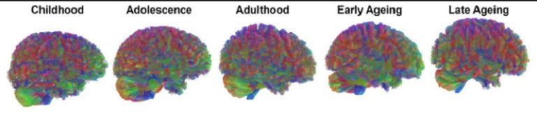 Maduración cerebral