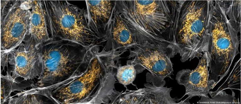 Recarga de células envejecidas