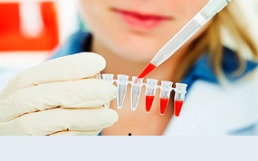 Diagnostico chikungunya