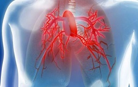 Hipertensión pulmonar