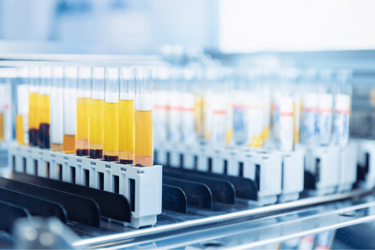 Estudio nanopartículas