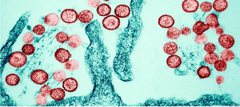 Hantavirus