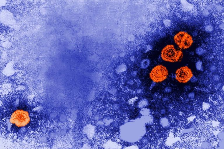 Hepatitis B