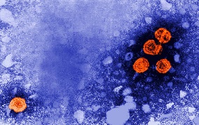 Hepatitis B