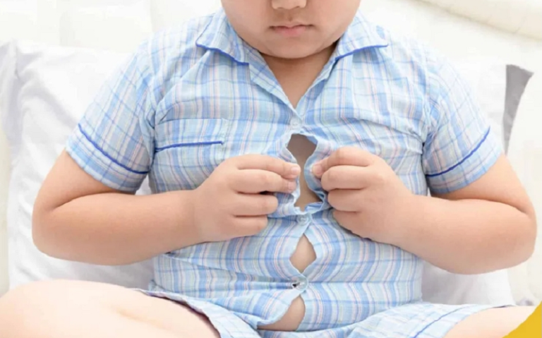 Obesidad infantil